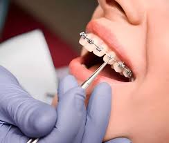 Dentes Bancos